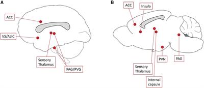 Translational aspects of deep brain stimulation for chronic pain